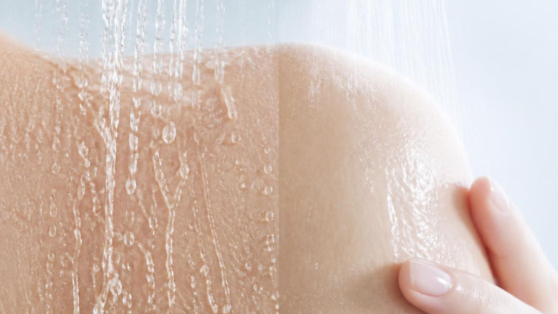 Chlore dans l'eau de la douche : pourquoi ta peau et tes cheveux tirent.